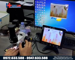 https://ytehueloi.com/image/cache/catalog/may-soi-mach-mau-dn880/hinh-anh-tu-may-soi-mach-mau-khi-ket-noi-may-tinh-250x200.jpg