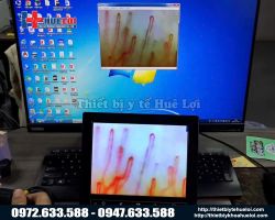 https://ytehueloi.com/image/cache/catalog/may-soi-mach-mau-dn880/ket-qua-hinh-anh-cua-may-soi-mach-mau-1200x-250x200.jpg
