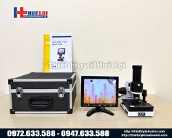 Kính hiển vi soi tuần hoàn máu cao cấp