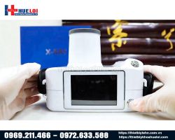 https://ytehueloi.com/image/cache/catalog/may-xquang-nha-khoa-apol-xr/man-hinh-cam-ung-4-inch-may-x-quang-nha-khoa-apolxr-250x200.jpg