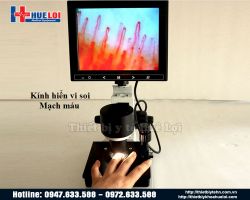 https://ytehueloi.com/image/cache/catalog/soi-mach-mau-ngon-tay/kinh-hien-vi-sinh-hoc-250x200.jpg