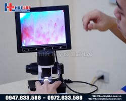 https://ytehueloi.com/image/cache/catalog/soi-mach-mau-ngon-tay/kinh-hien-vi-soi-mach-250x200.jpg