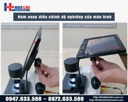 https://ytehueloi.com/image/cache/catalog/soi-mach-mau-ngon-tay/man-hinh-kinh-hien-vi-soi-mach-250x200.jpg