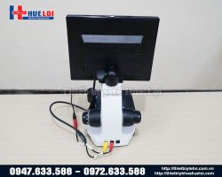 https://ytehueloi.com/image/cache/catalog/soi-mach-mau-ngon-tay/mat-sau-kinh-hien-vi-soi-mach-250x200.jpg