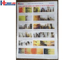 https://ytehueloi.com/image/cache/catalog/soi-mach-mau-ngon-tay/tranh-treo-tuong-kinh-hien-vi-250x200.jpg