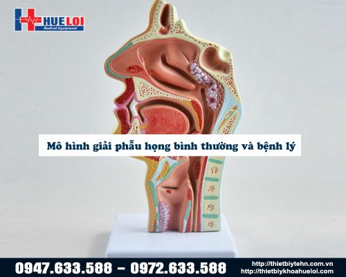 Mô hình giải phẫu họng bình thường và bệnh lý