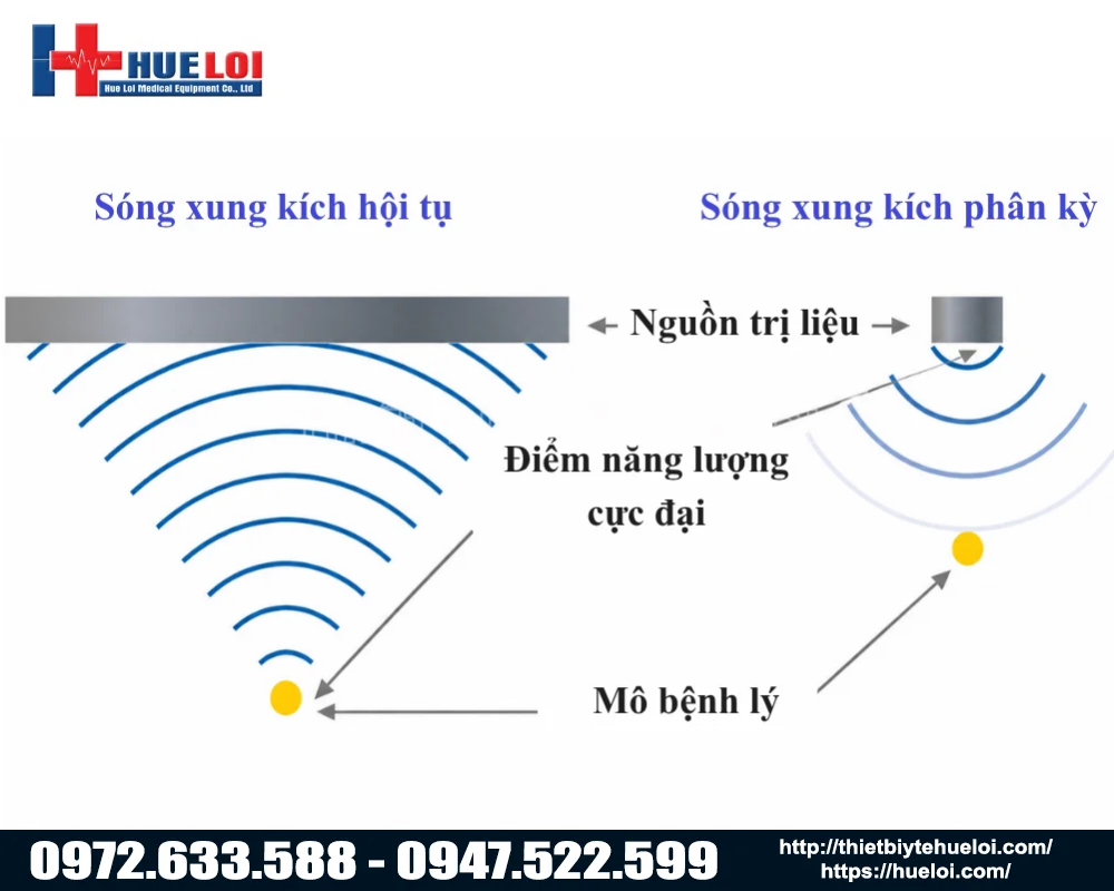 m&aacute;y điều trị s&oacute;ng xung k&iacute;ch &aacute;p điện 