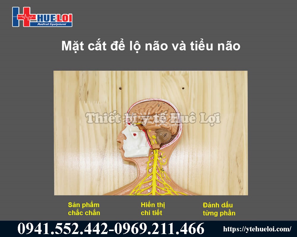 Mặt cắt dọc hiển để lộ rõ phần não và tiểu não, các dây thần kinh