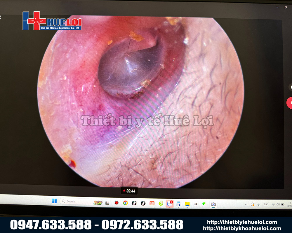 máy nội soi tai mũi họng cầm tay giá rẻ