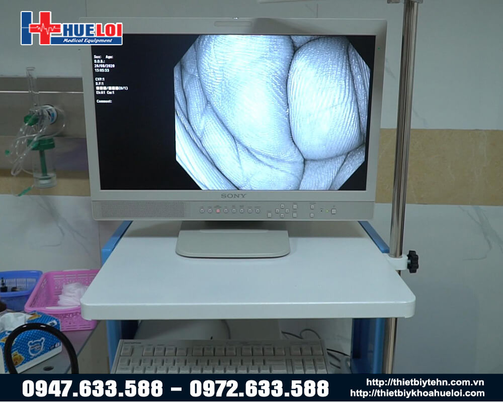 máy nội soi dạ dày cv 170