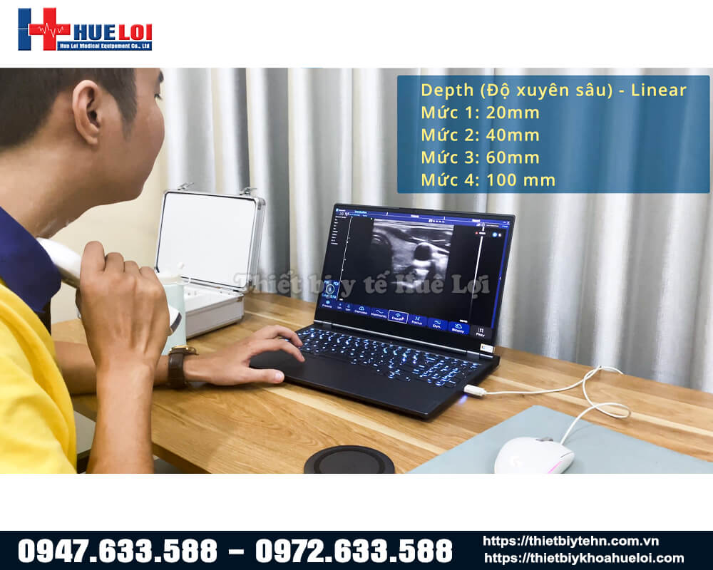 chất lượng hình ảnh thực tế đầu dò siêu âm không dây