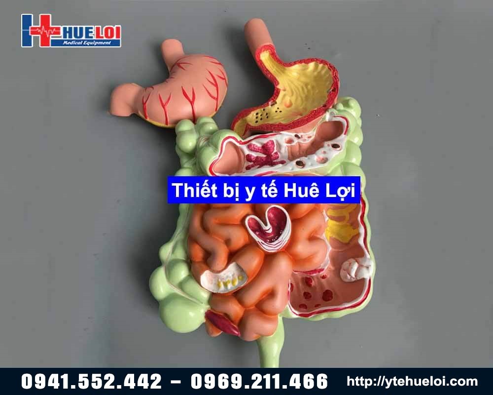 mô hình dạ dày ruột tháo rời
