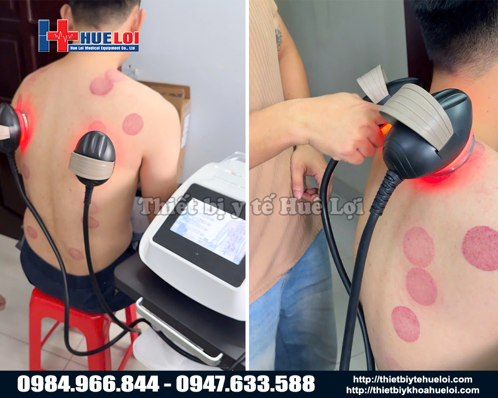 máy điện sinh học thế hệ mới