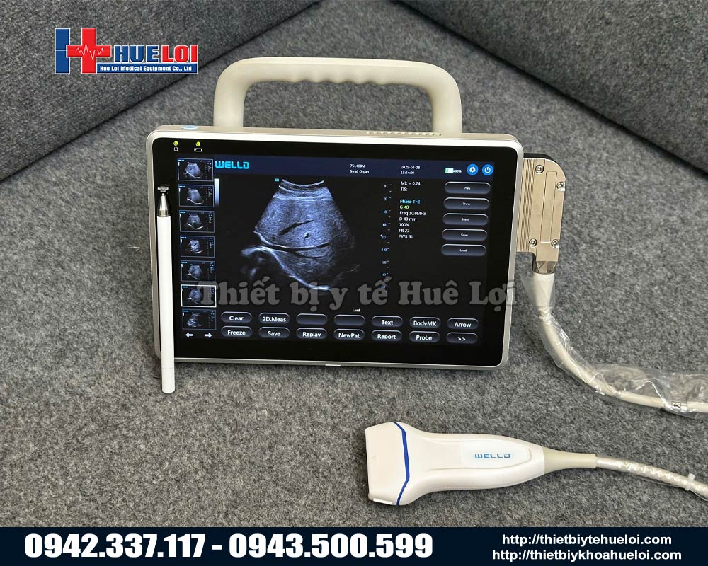 máy siêu âm cầm tay