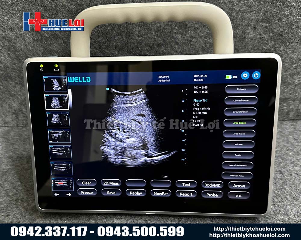 máy siêu âm mini giá rẻ