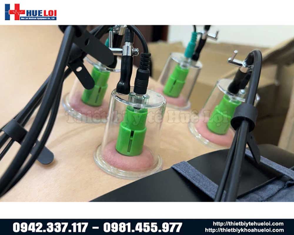 điện châm kết hợp giác hút máy điện châm giá rẻ
