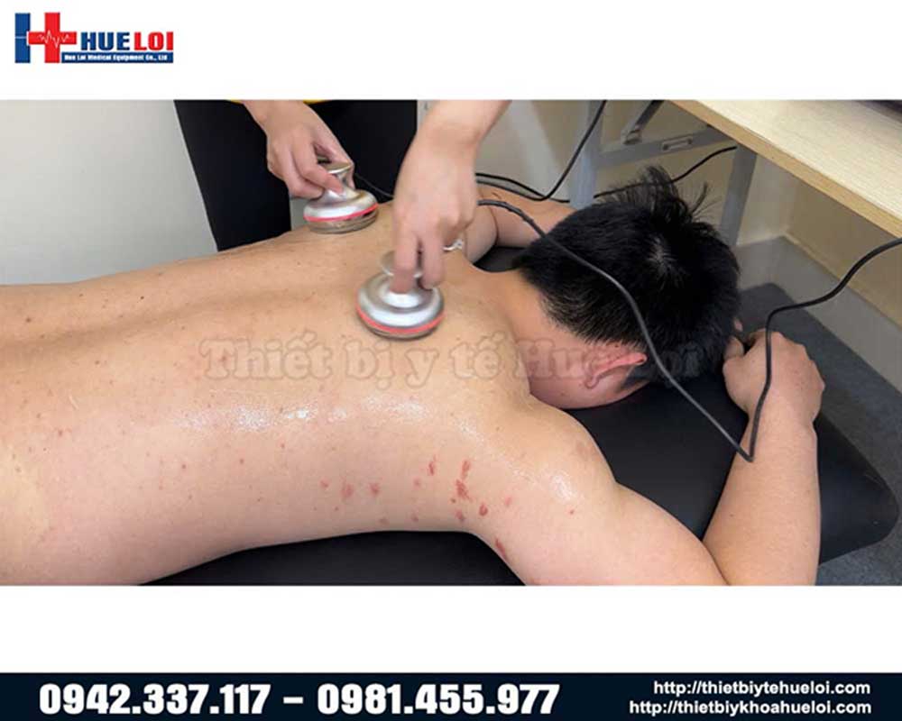 chế độ xung trị liệu máy châm cứu không kim
