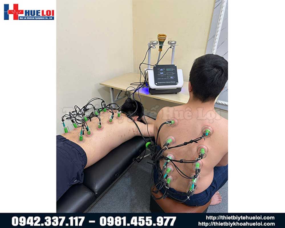 máy điện châm không xâm lấn giá rẻ
