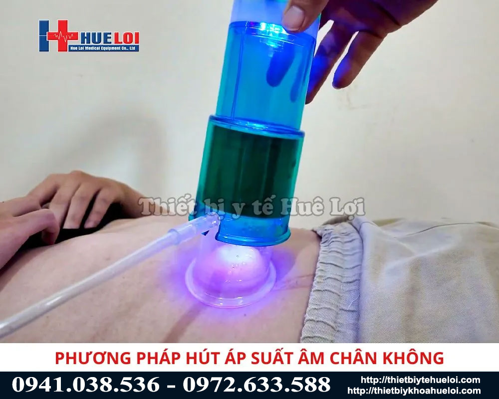 Phương ph&aacute;p h&uacute;t &aacute;p suất &acirc;m ch&acirc;n kh&ocirc;ng của m&aacute;y điều trị xuất tinh sớm