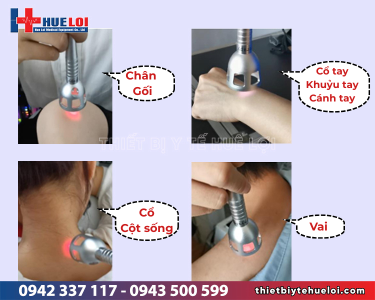 máy laser trị liệu công xuất cao