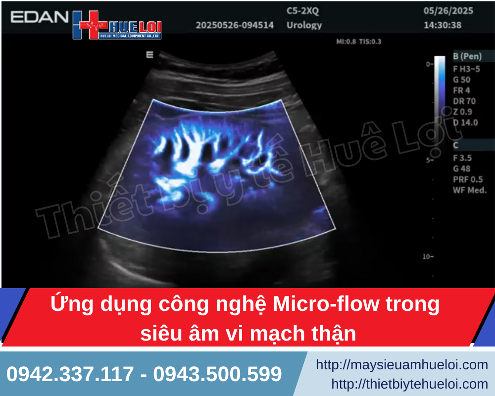 chất lượng hình ảnh siêu âm