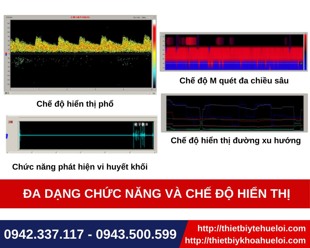 thiết bị siêu âm sọ não công nghệ cao