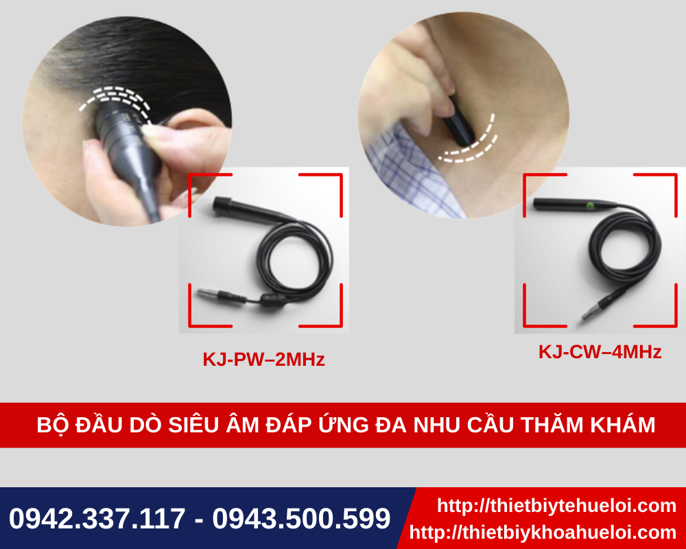 siêu âm sọ não thế hệ mới