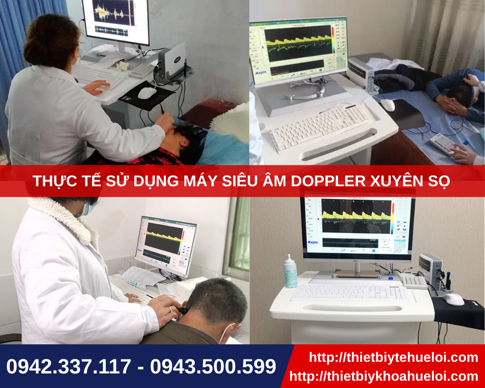 thiết bị siêu âm sọ não