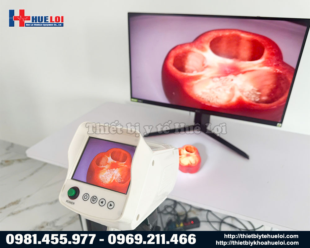 H&igrave;nh ảnh thực tế m&aacute;y soi cổ tử cung SW 304