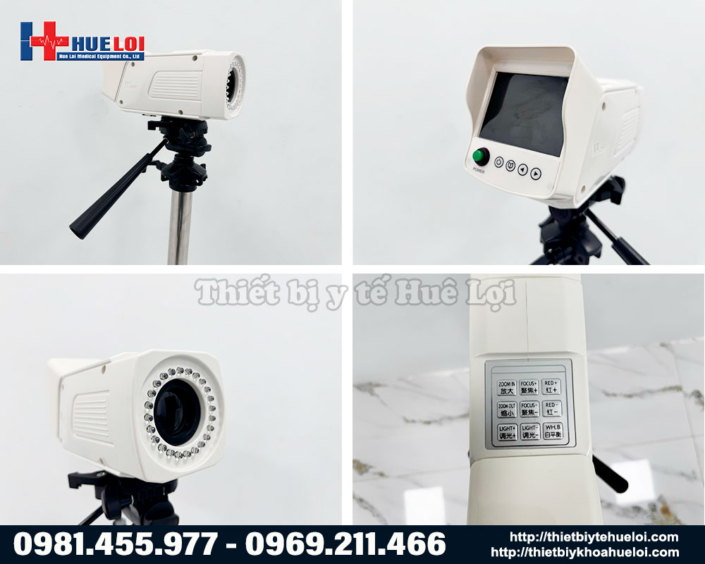 H&igrave;nh ảnh thực tế m&aacute;y soi cổ tử cung full HD SW 304 