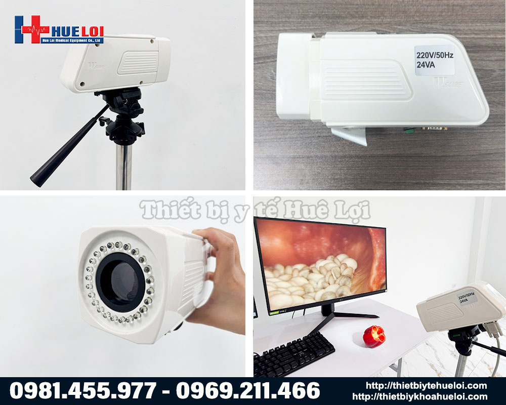 Bộ m&aacute;y soi cổ tử cung SW302 Hu&ecirc; Lợi