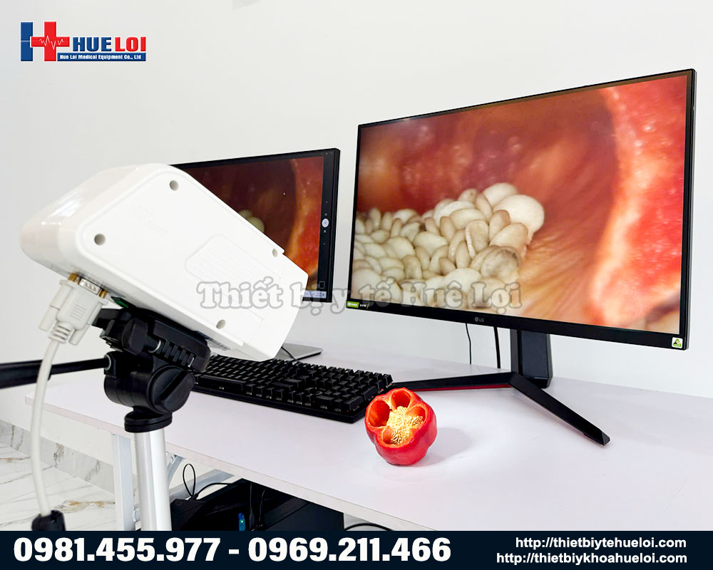 m&aacute;y soi cổ tử cung gi&aacute; rẻ ch&iacute;nh h&atilde;ng