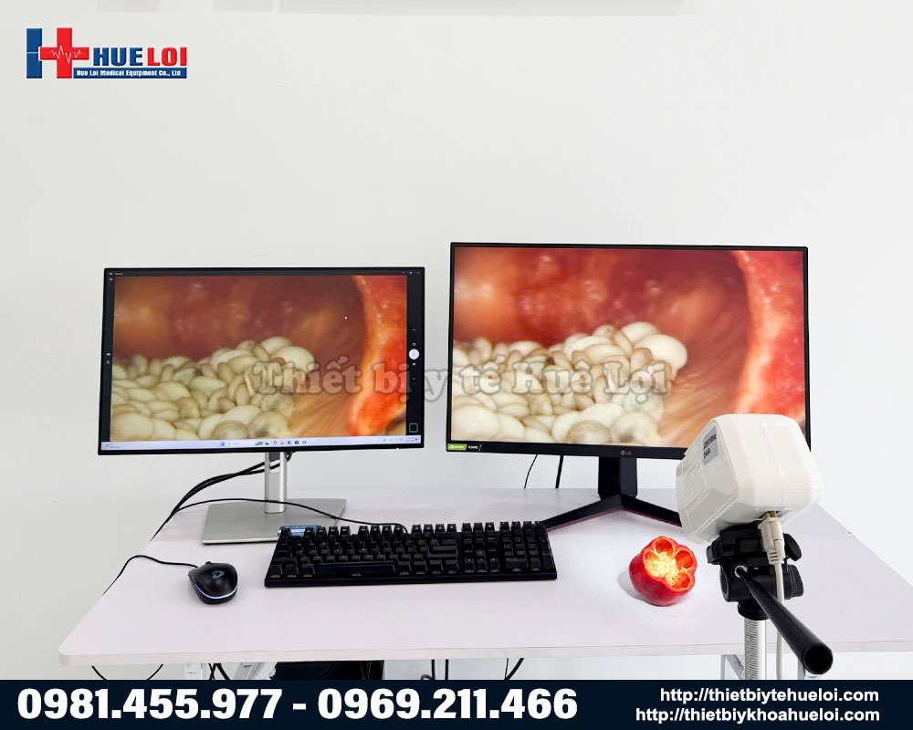 m&aacute;y soi cổ tử cung kết nối m&aacute;y t&iacute;nh