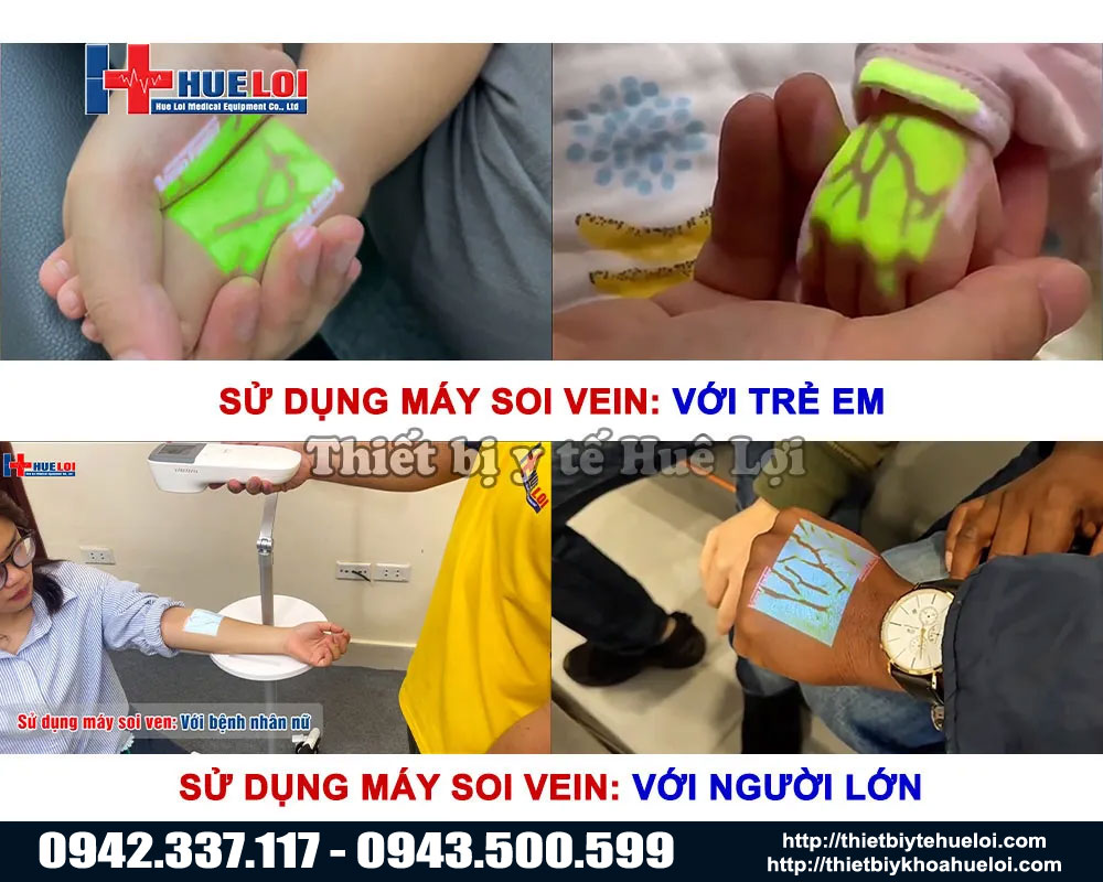 máy soi ven di động