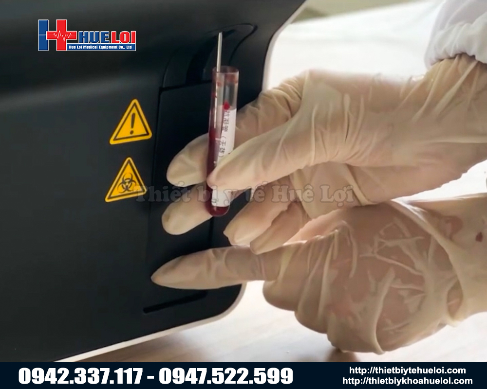 Máy phân tích máu thú y