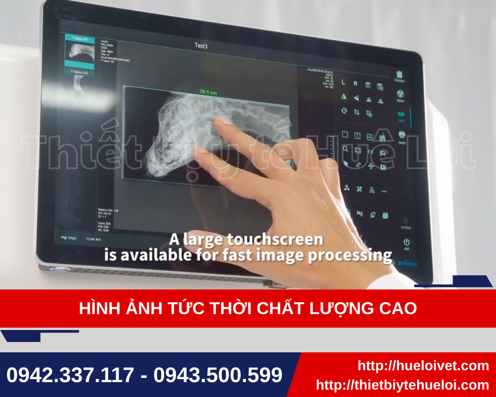 chất lượng hình ảnh thực tế máy x quanng