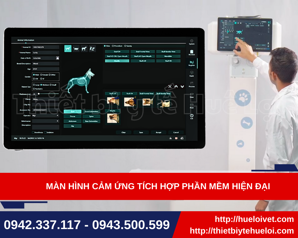 hình ảnh máy xquang chất lượng cao