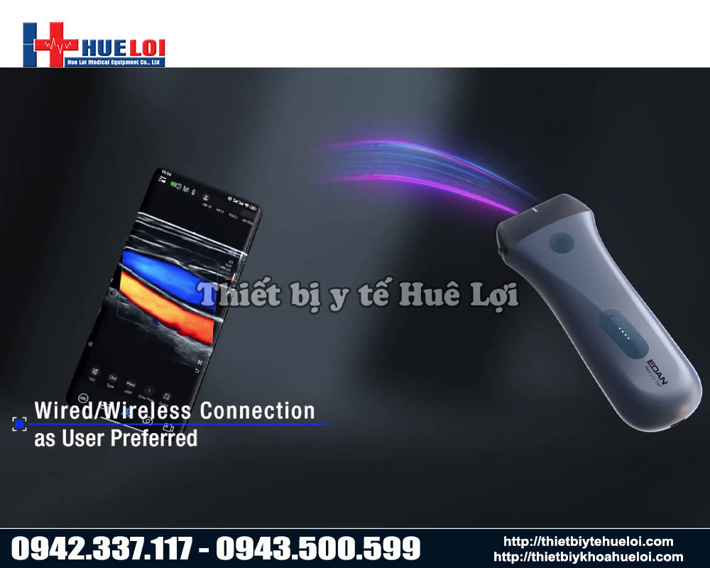 Máy chẩn đoán hình ảnh cầm tay cao cấp