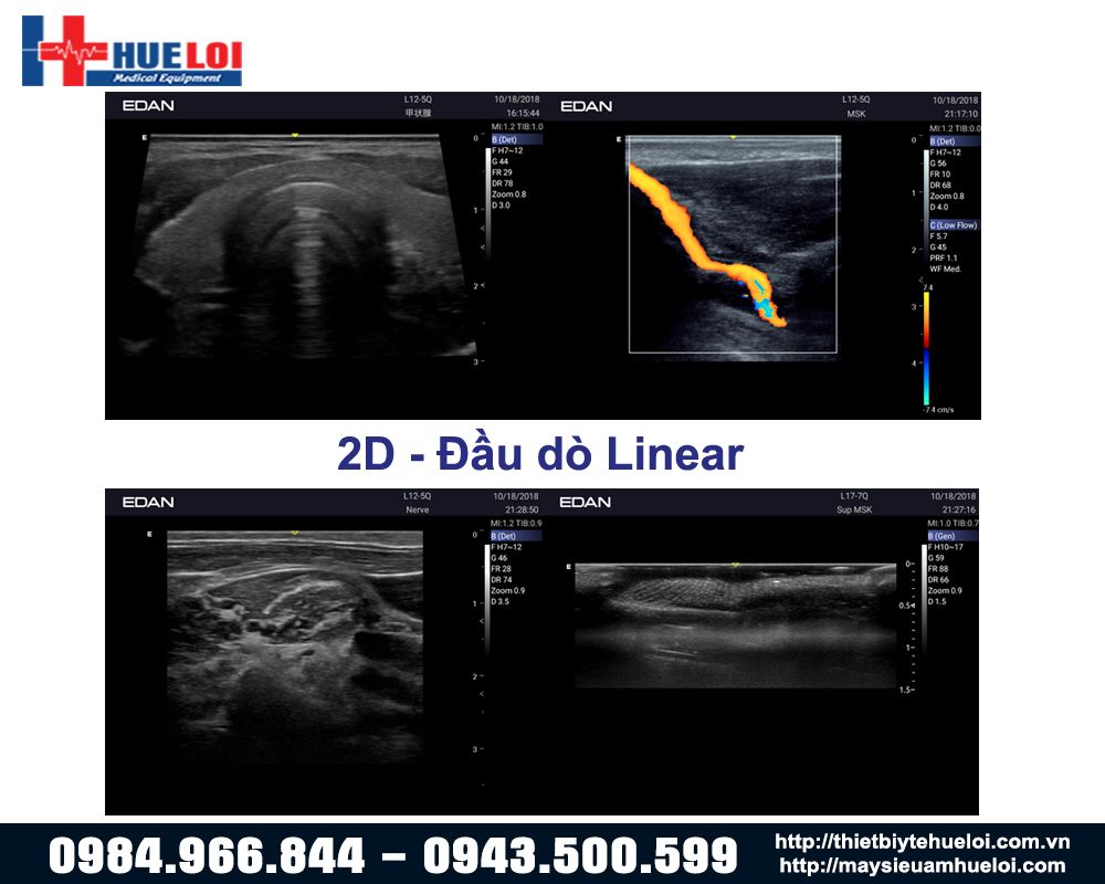 hình ảnh đầu rò linear máy siêu âm sách tay edan ax3