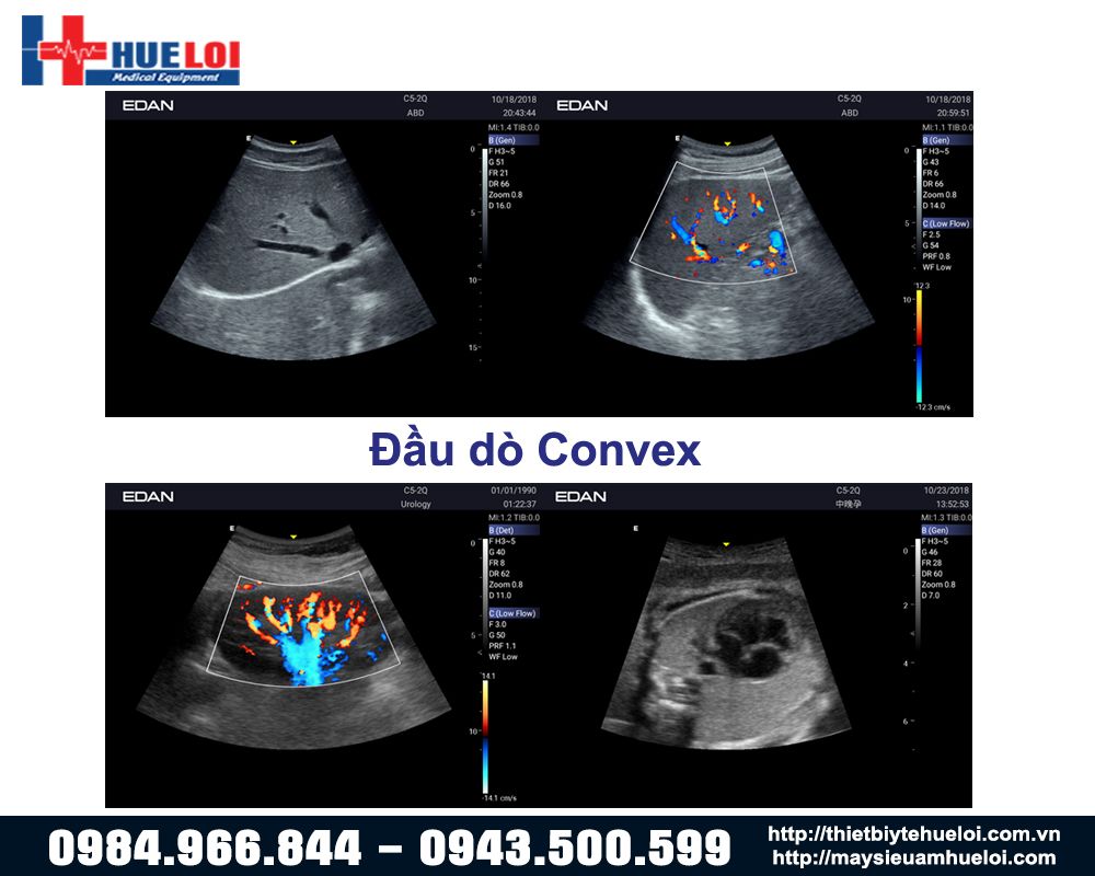 đầu rò convex máy siêu âm ax3