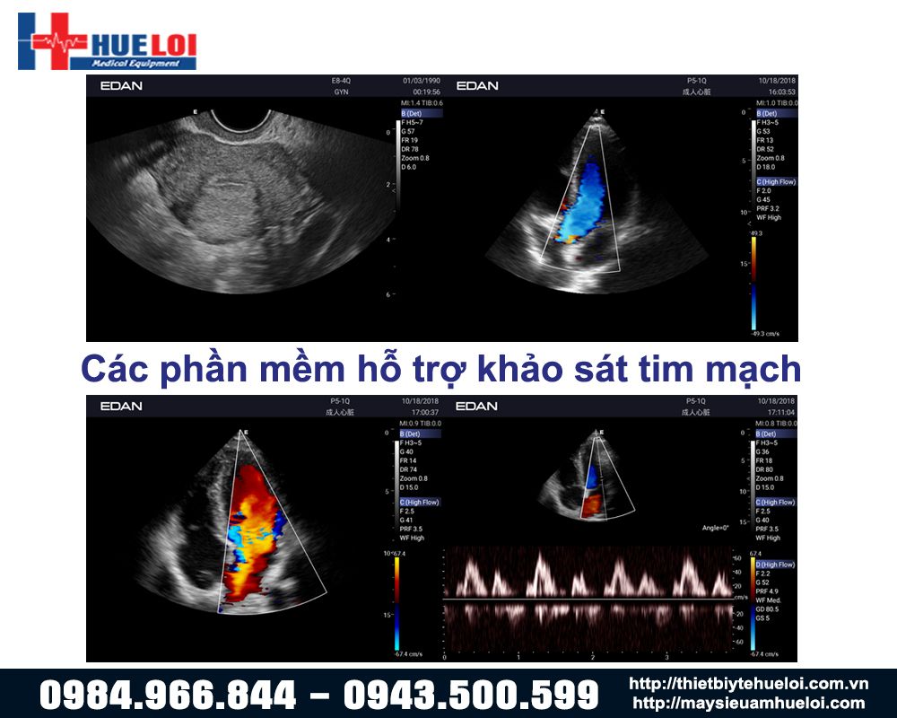 hình ảnh phần mềm hỗ trợ hình ảnh máy siêu âm