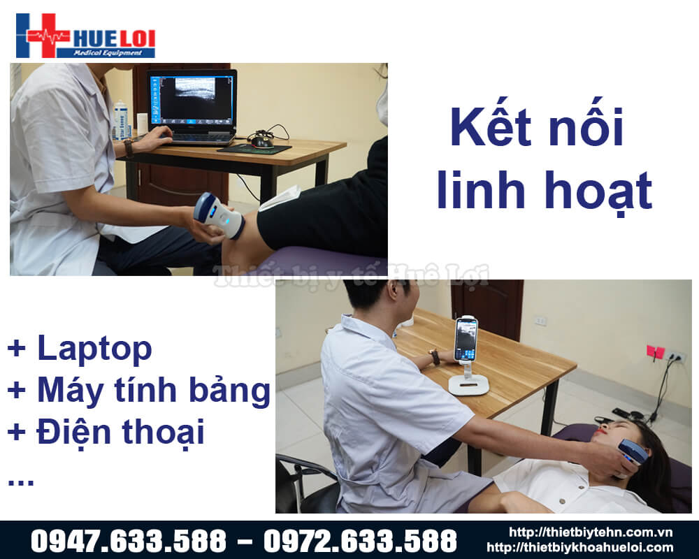 máy siêu âm kết nối với máy tính điện thoại