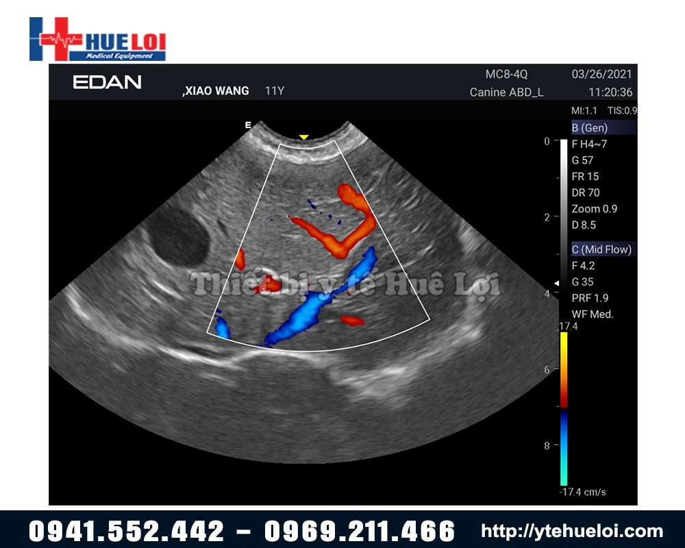 siêu âm doppler của máy siêu âm edan ax3 vet